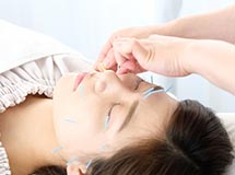 よもぎ鍼灸整骨院の施術の様子