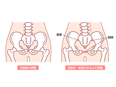 産後の腰痛のイラスト