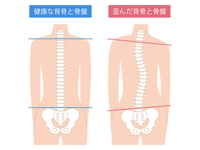 産後の腰痛のイラスト